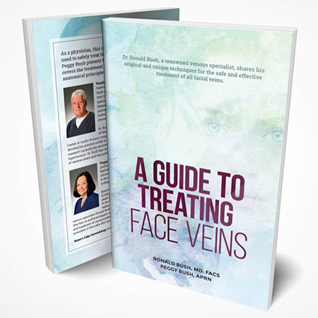 Guide to treating face veins